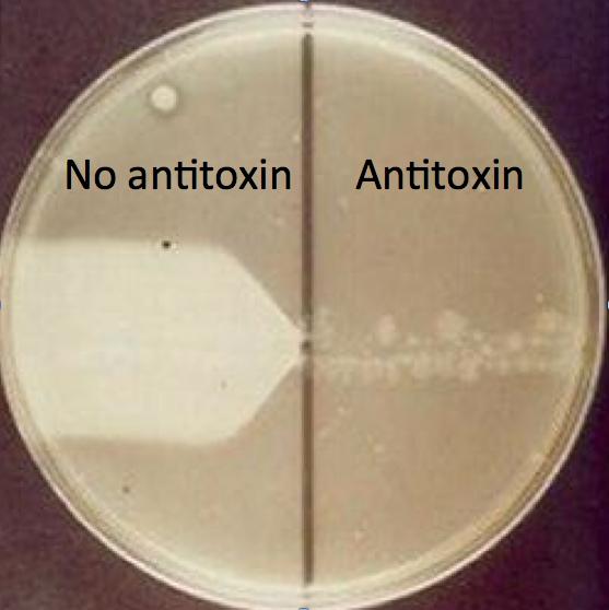 Clostridium perfringens Microbiology Medbullets Step 1